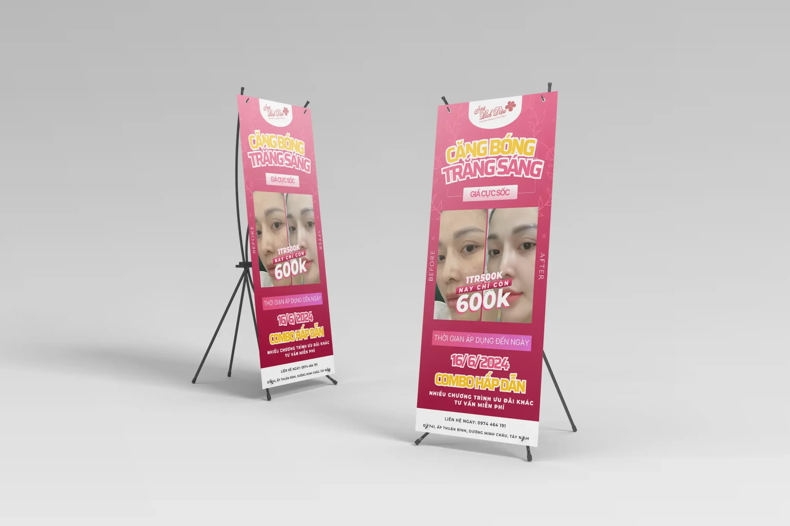 Thiết kế Standee Bích Diệu Spa 6 standee scaled